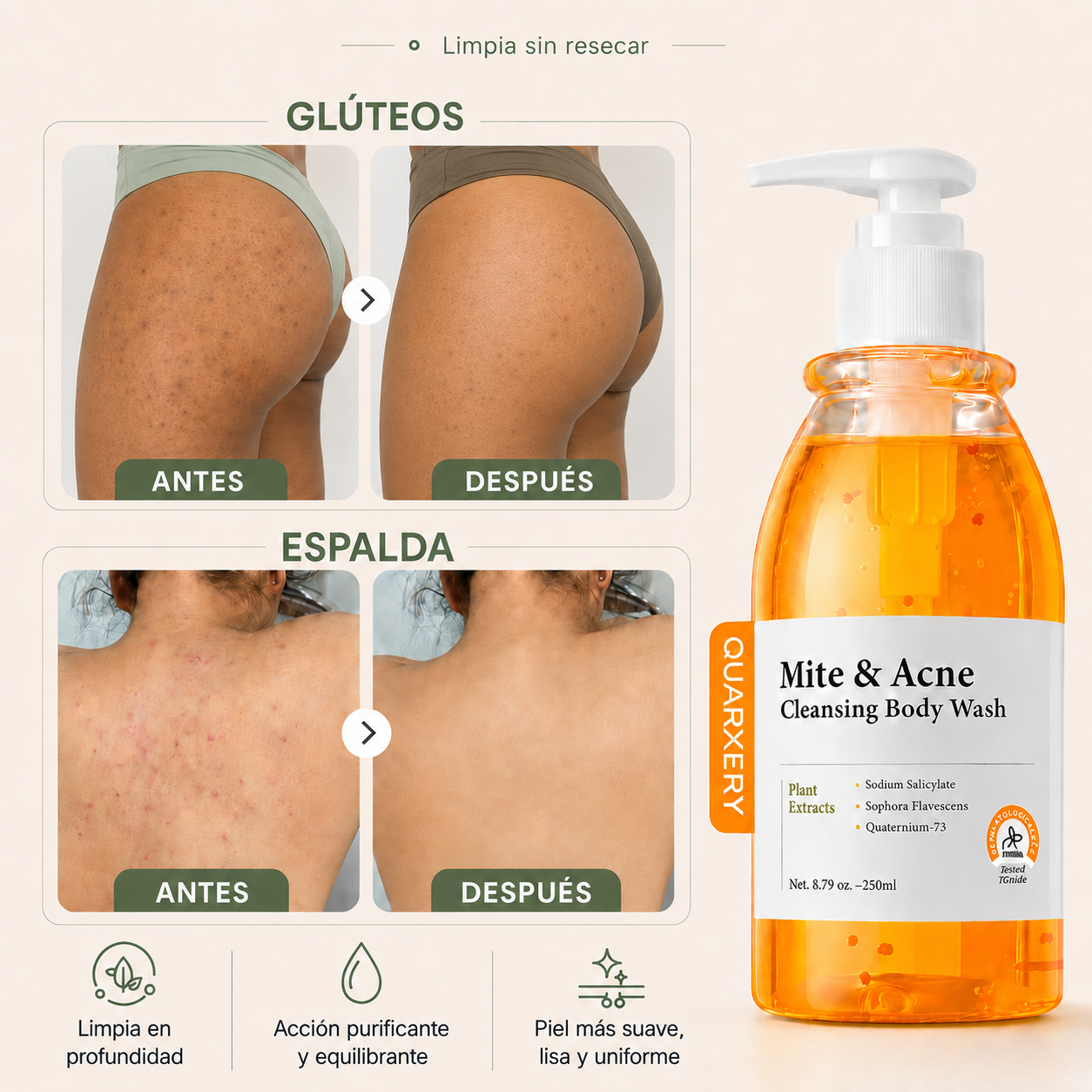 MITE & ACNE