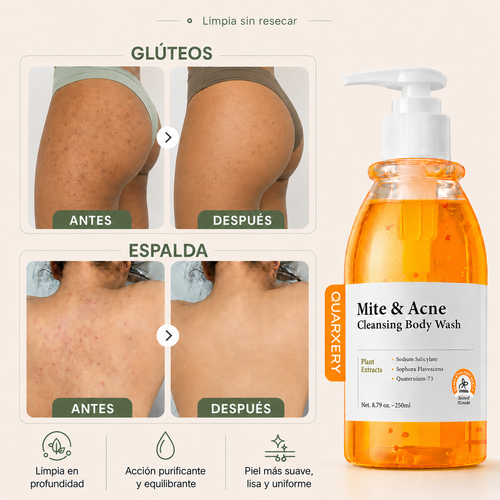 MITE & ACNE